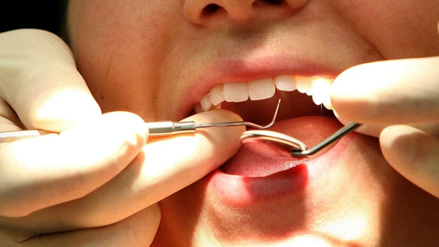 bai-viet/thuoc-diet-tuy-rang-la-gi-va-mot-so-luu-y-sau-khi-dat-thuoc.html