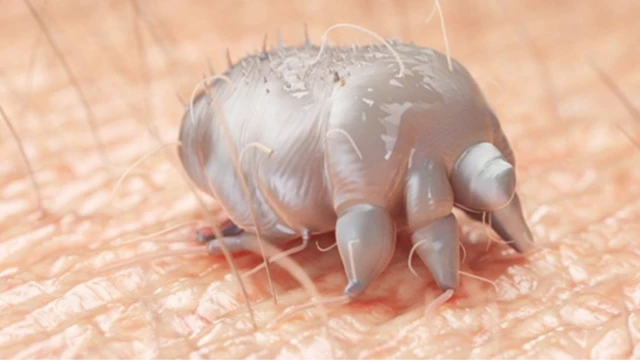 bai-viet/thuoc-tri-ghe-nuoc-nao-an-toan-va-hieu-qua-luu-y-khi-dieu-tri-ghe-nuoc-bang-thuoc.html