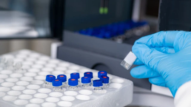 bai-viet/thuoc-uc-che-pcsk-9-giai-phap-moi-ho-tro-dieu-tri-benh-roi-loan-mo-mau-hieu-qua.html