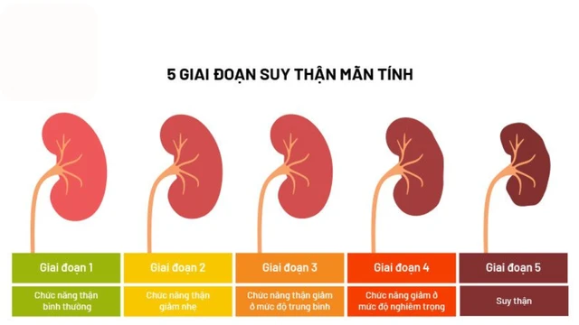 bai-viet/tieu-chuan-chan-doan-suy-than-man-va-anh-huong-cua-suy-than-man-toi-suc-khoe-tong-the.html