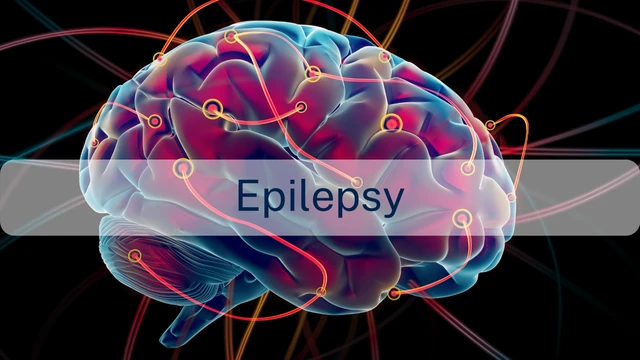 bai-viet/tim-hieu-cac-cach-chua-benh-dong-kinh-khoa-hoc.html