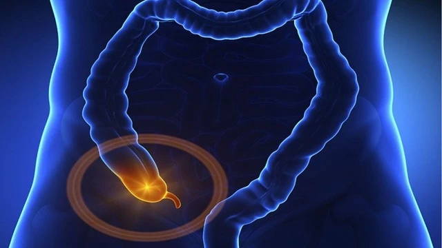 bai-viet/tim-hieu-cac-the-viem-ruot-thua-thuong-gap.html