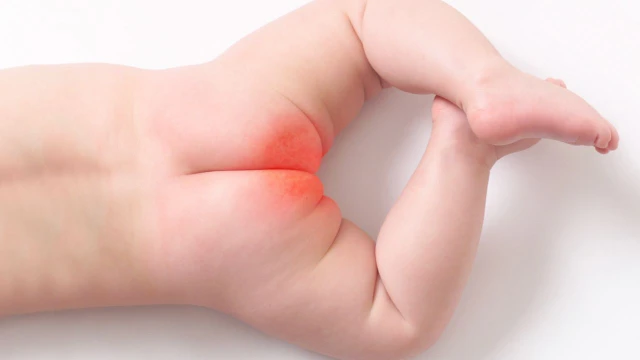 bai-viet/tim-hieu-cach-cham-soc-tre-bi-ham-do-hau-mon-hieu-qua-tai-nha.html