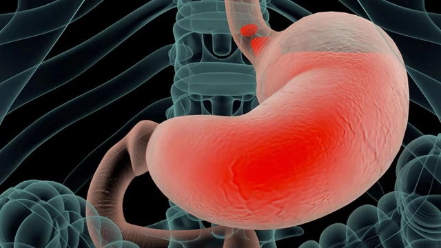 bai-viet/tim-hieu-da-day-duoc-cau-tao-boi-may-lop-co-ban-va-benh-ly-thuong-gap.html