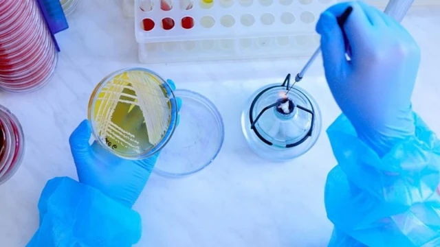 bai-viet/tim-hieu-mot-so-moi-truong-nuoi-cay-vi-khuan.html