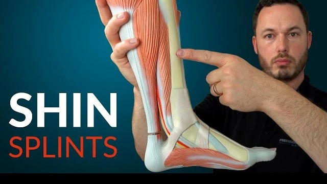 bai-viet/tim-hieu-shin-splints-la-gi-nguyen-nhan-trieu-chung-va-bien-phap-dieu-tri-shin-splints.html