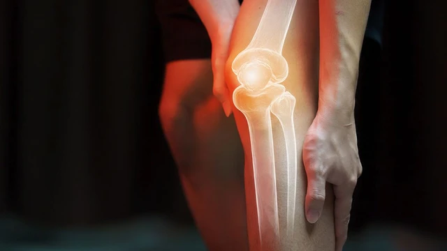 bai-viet/tim-hieu-ve-benh-osteosarcoma-xuong-ung-thu-xuong.html