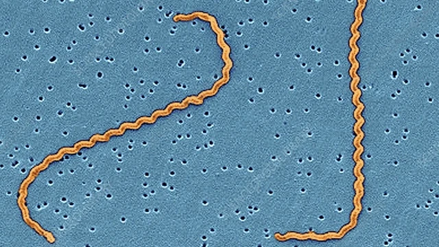 bai-viet/tim-hieu-ve-benh-xoan-khuan-vang-da.html