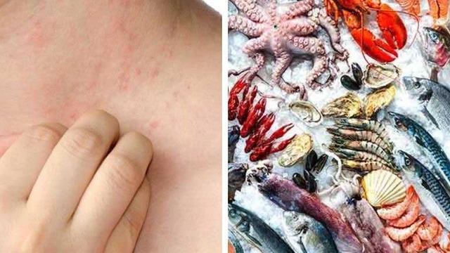 bai-viet/tim-hieu-ve-di-ung-hai-san-noi-me-day-61068.html