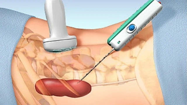 bai-viet/tim-hieu-ve-sinh-thiet-than-duoi-huong-dan-sieu-am.html