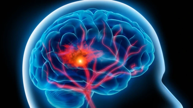 bai-viet/tim-hieu-ve-su-hinh-thanh-cuc-mau-dong-trong-tai-bien-mach-mau-nao.html