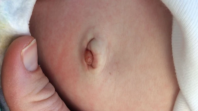 bai-viet/ton-tai-ong-nieu-ron-nguyen-nhan-trieu-chung-va-cach-dieu-tri.html