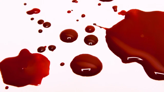 bai-viet/tinh-trang-bang-huyet-sau-sinh-muon-nguyen-nhan-va-cach-dieu-tri.html