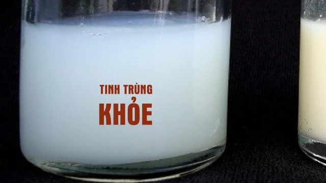 bai-viet/tinh-trung-mau-trang-sua-co-tot-khong.html