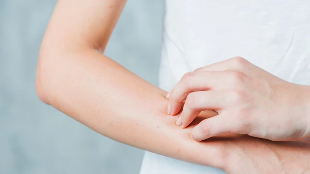 bai-viet/to-dia-cham-dang-trung-sam-nguyen-nhan-trieu-chung-cach-dieu-tri-55204.html