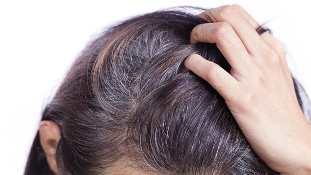 bai-viet/toc-bac-som-thieu-chat-gi.html