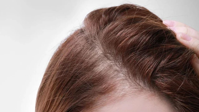 bai-viet/nguyen-nhan-toc-con-moc-lom-chom-va-cach-cai-thien.html