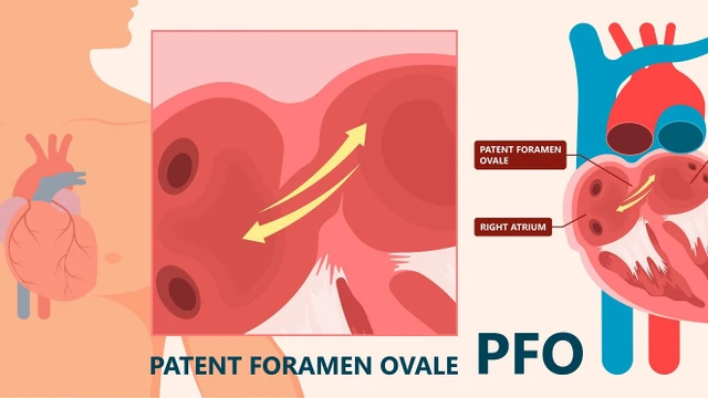 bai-viet/tinh-trang-ton-tai-lo-bau-duc-trong-tim-co-nguy-hiem-khong.html