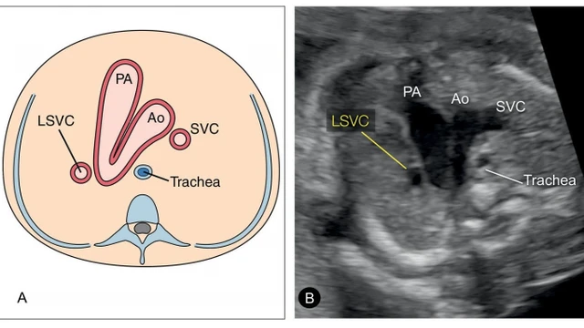 bai-viet/tim-hieu-ve-di-tat-ton-tai-tinh-mach-chu-tren-trai.html