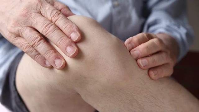 bai-viet/tong-hop-cac-thong-tin-can-biet-khi-bi-bong-gan-dau-goi-phai-51202.html