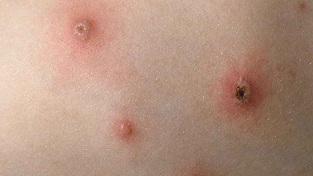 bai-viet/tong-hop-hinh-anh-thuy-dau-qua-cac-giai-doan.html