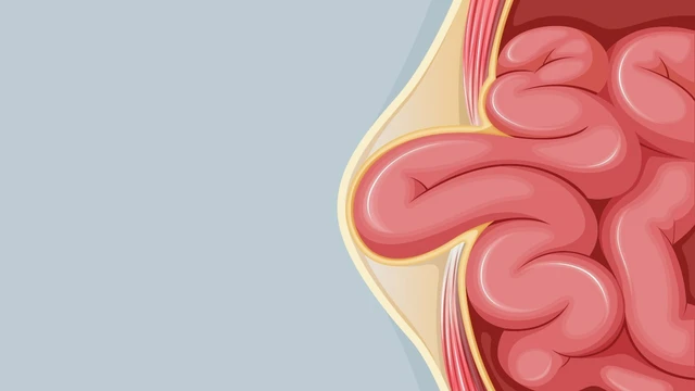 bai-viet/tong-quan-ve-chung-sa-ruot.html