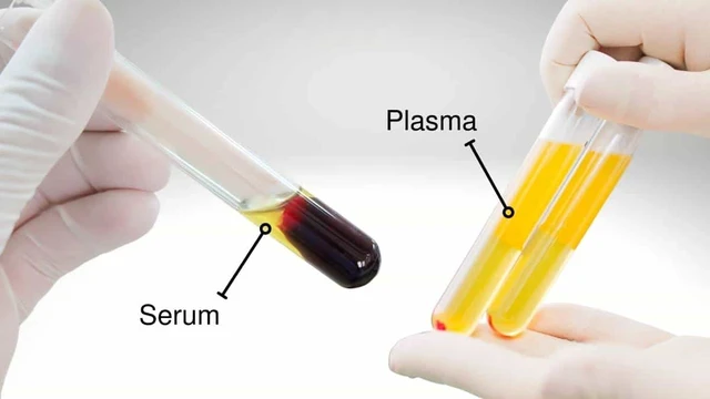 bai-viet/thong-tin-tong-quan-cach-phan-biet-huyet-thanh-va-huyet-tuong.html