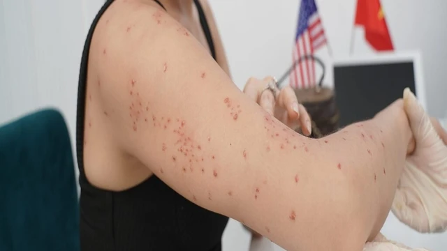 bai-viet/top-7-thuoc-tri-viem-nang-long-pho-bien-nhat-co-the-ban-chua-biet.html