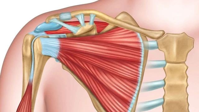 bai-viet/tran-dich-khop-vai-la-gi-phuong-phap-dieu-tri-tran-dich-khop-vai.html