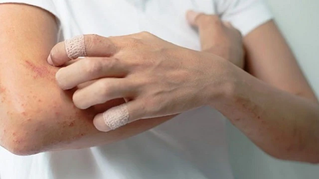 bai-viet/trangala-la-thuoc-gi-nhung-dieu-luu-y-khi-su-dung-thuoc-trangala-66655.html