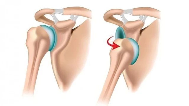 bai-viet/trat-khop-co-tu-khoi-duoc-khong-truong-hop-nao-can-den-benh-vien.html