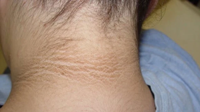 bai-viet/tre-bi-benh-gai-den-nguyen-nhan-trieu-chung-va-cach-dieu-tri.html