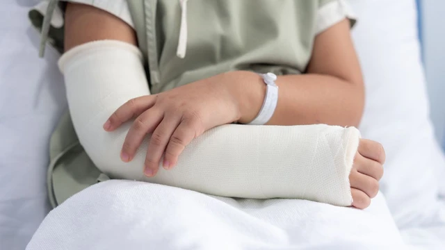 Trẻ bị gãy tay bó bột trong bao lâu? Làm thế nào để trẻ nhanh hồi phục?