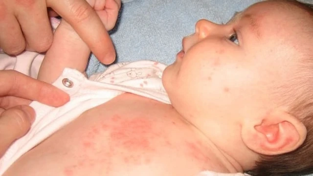 bai-viet/tre-bi-ngua-ve-dem-nguyen-nhan-va-cach-khac-phuc.html