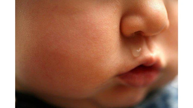 bai-viet/tre-bi-so-mui-keo-dai-nguyen-nhan-do-dau.html