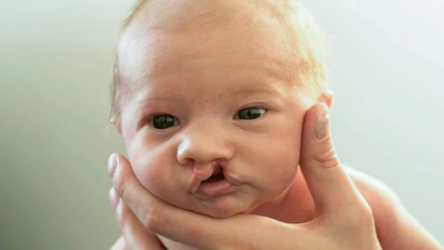 bai-viet/sut-moi-ho-ham-ech-co-di-truyen-khong-cach-phong-ngua.html