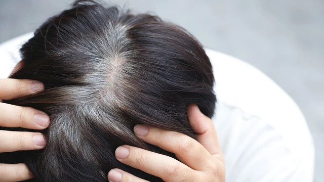 bai-viet/tre-em-toc-bac-som-kham-o-dau-goi-y-nhung-dia-chi-uy-tin-tai-ha-noi-va-tp-hcm.html