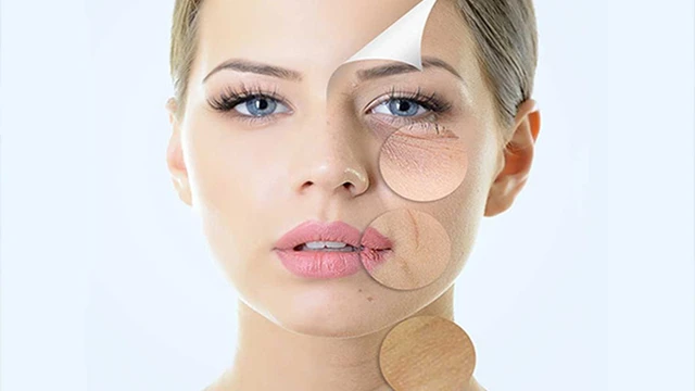 bai-viet/tre-hoa-da-bang-cong-nghe-anh-sang-ipl-72916.html