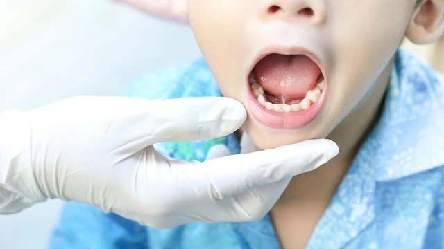 bai-viet/tre-luoi-ngan-kho-phat-am-nen-dieu-tri-nhu-the-nao.html