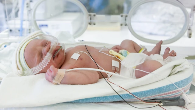 bai-viet/tre-sinh-non-tho-cpap-loi-ich-va-quy-trinh-thuc-hien.html