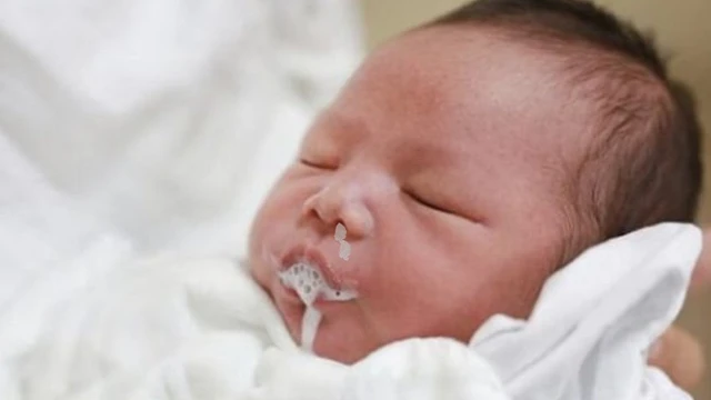 bai-viet/tre-so-sinh-bi-oc-sua-va-tho-kho-khe-nguyen-nhan-va-cach-khac-phuc.html