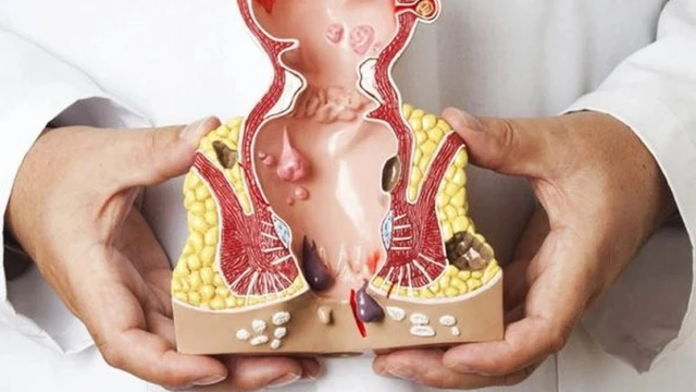 bai-viet/tri-ngoai-do-4-la-gi-cac-bieu-hien-cua-tri-ngoai-do-4.html