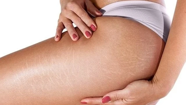 bai-viet/tri-ran-da-mong-lau-nam-co-hieu-qua-khong-cach-chua-the-nao-56538.html