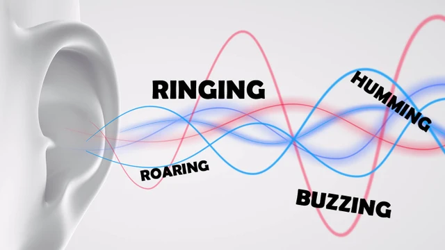 bai-viet/trieu-chung-benh-meniere-60079.html