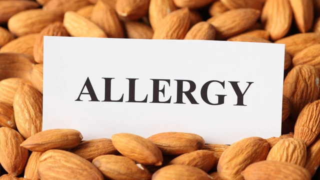 bai-viet/trieu-chung-cua-di-ung-hanh-nhan-la-gi-can-lam-gi-khi-bi-di-ung-hanh-nhan.html