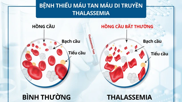bai-viet/thieu-mau-bam-sinh-nguyen-nhan-trieu-chung-va-cach-dieu-tri.html