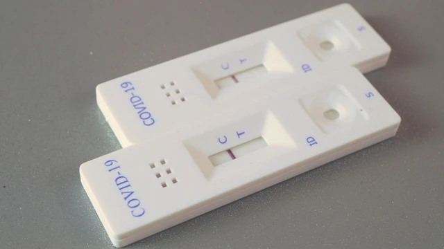 bai-viet/trieu-chung-covid-19-theo-tung-muc-do-benh-tu-nhe-den-nang.html