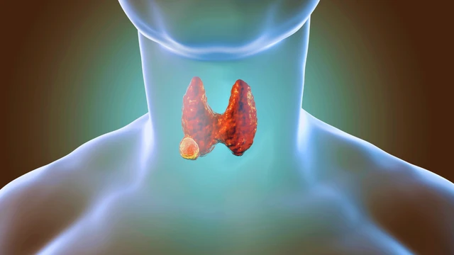 bai-viet/trieu-chung-u-tuyen-giap-lanh-tinh-va-nhung-dieu-can-biet.html