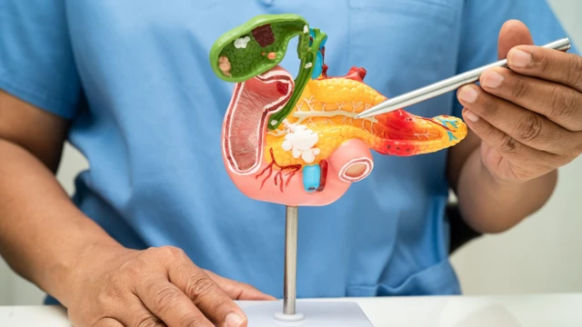 bai-viet/can-canh-giac-cao-do-voi-nhung-trieu-chung-viem-tuy-cap-nay.html