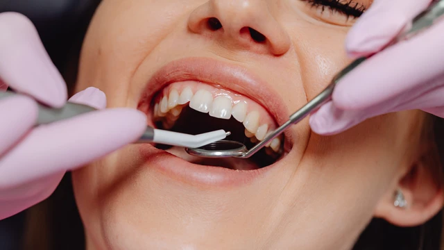 bai-viet/trong-rang-cua-co-dau-khong-nhung-phuong-phap-trong-rang-cua-pho-bien-hien-nay.html